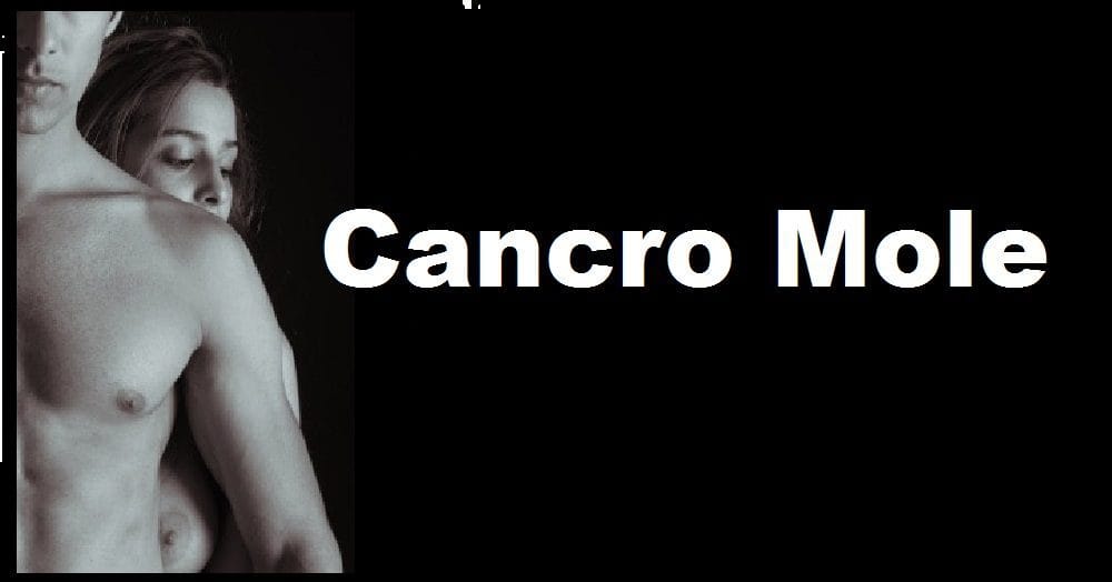 cancro mole ou cancroide