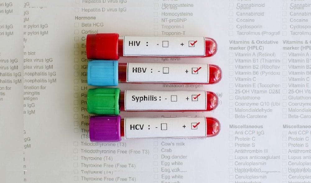 Infecções Sexualmente Transmissíveis