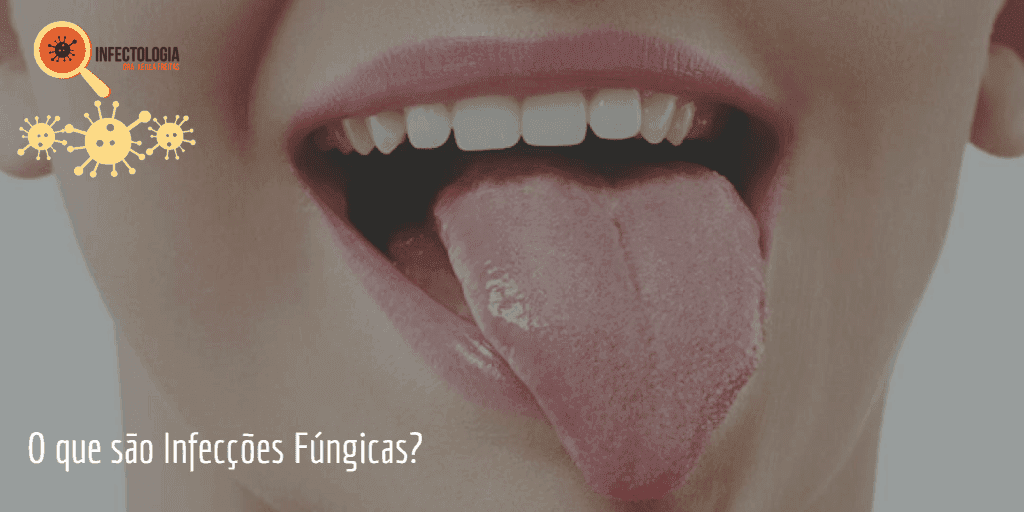 infeccoes-fungicas