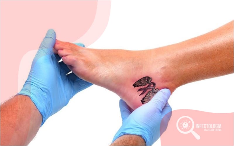 Tatuagem e Risco de Infecções