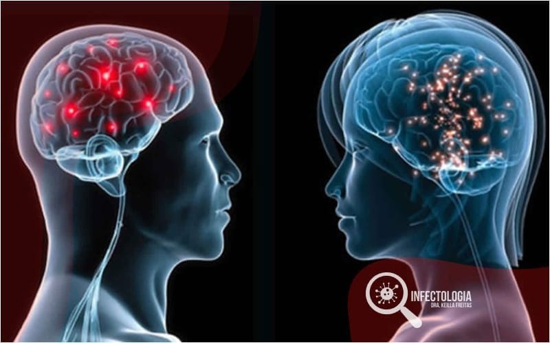 Neurossífilis